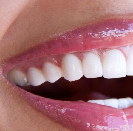 big-smile-gums-lipstick